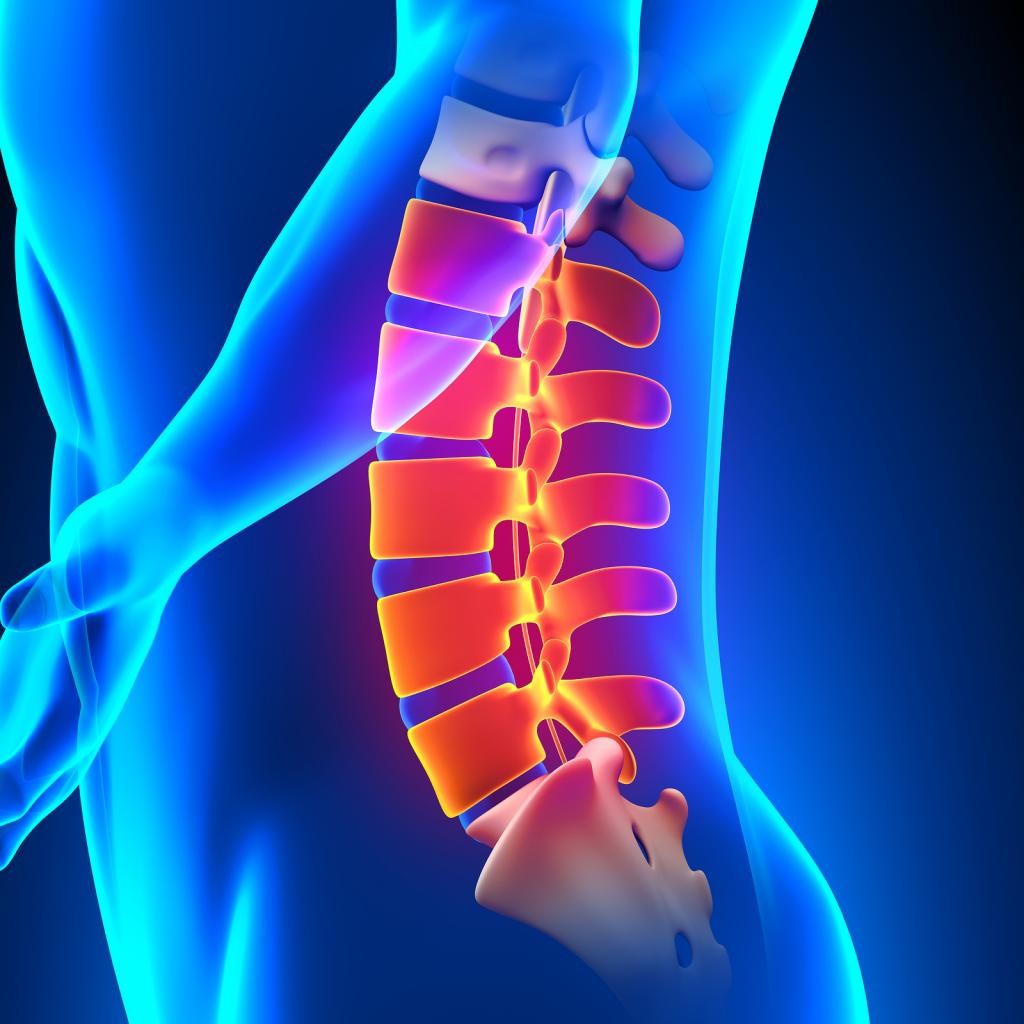 Osteohondroz-diskov-poyasnichno-krestcovogo-otdela